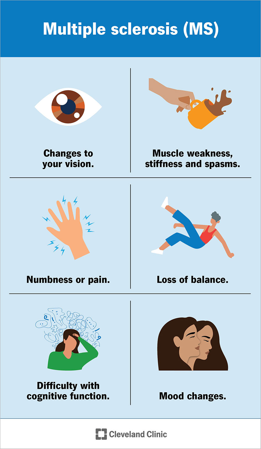 Multiple Sclerosis (MS): What It Is, Symptoms & Treatment