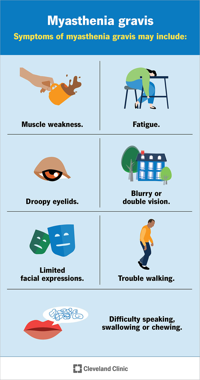 Seven common symptoms of myasthenia gravis.