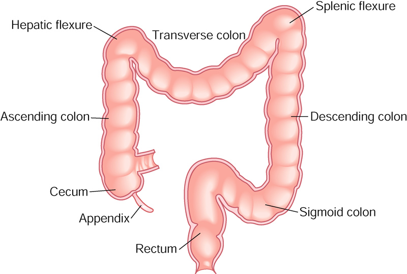 Illustration of the appendix, rectum, cecum, ascending colon, hepatic flexure, transverse colon, splenic flexure, descending colon, and sigmoid colon.