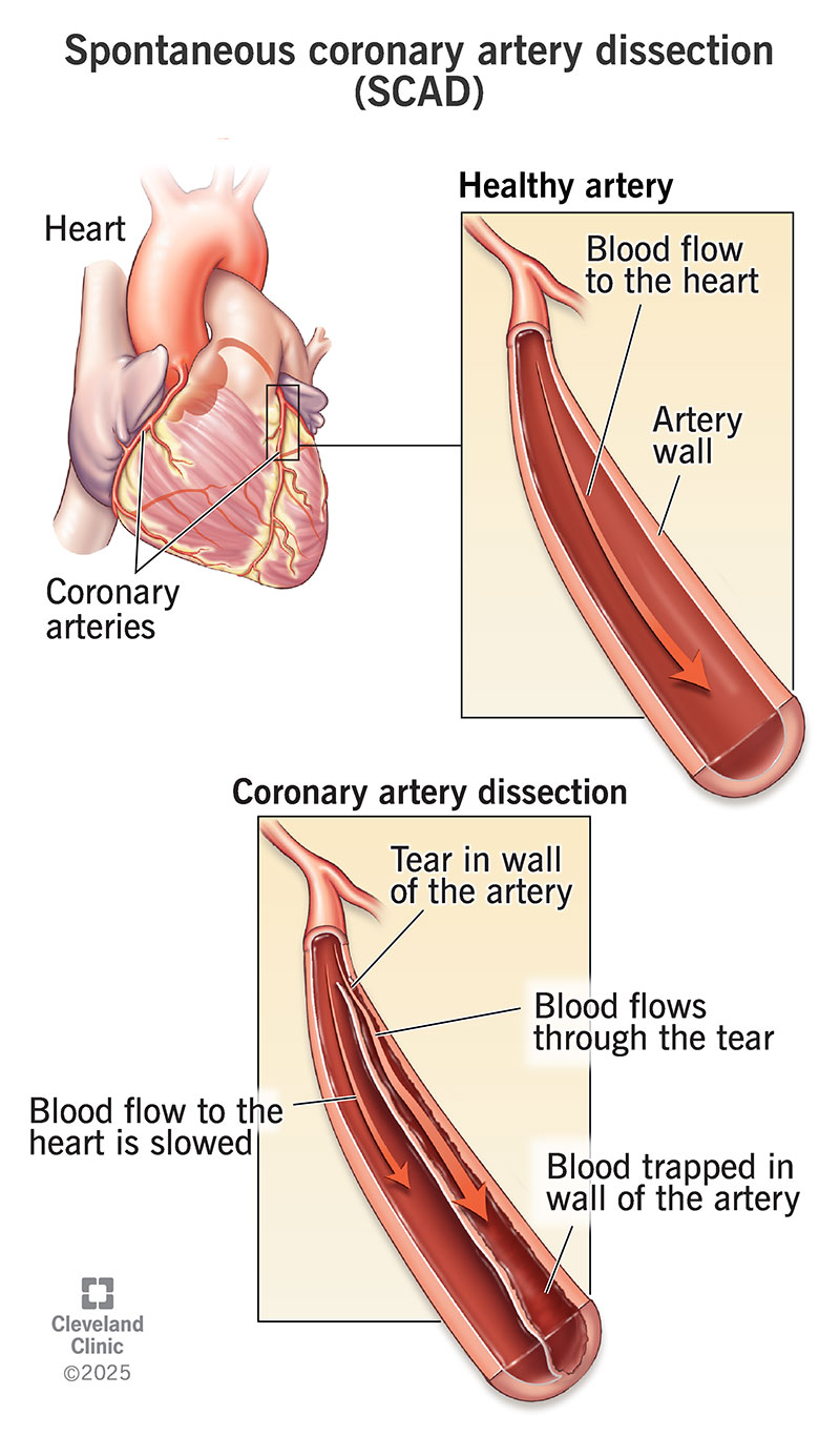 thumbnail image 2 of Healthy Flow Blood Support Supplement - Cardiovascular Circulation 60 Capsules 2 of 6