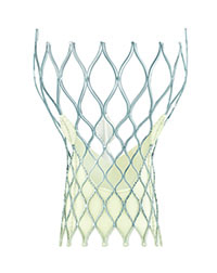 Transcatheter Aortic Valve Replacement (TAVR)