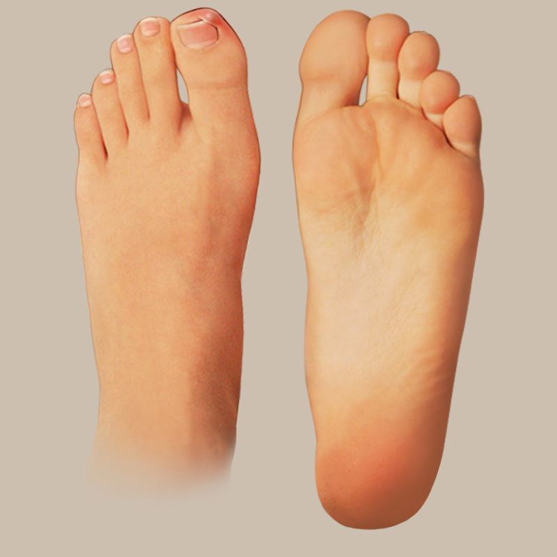 Ingrown toenails develop when the corner of the toenail grows down into the skin.