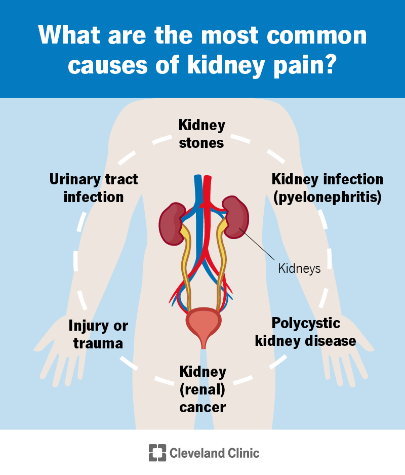 Common kidney pain causes include kidney stones, UTIs, injury, infection, polycystic kidney disease and cancer.