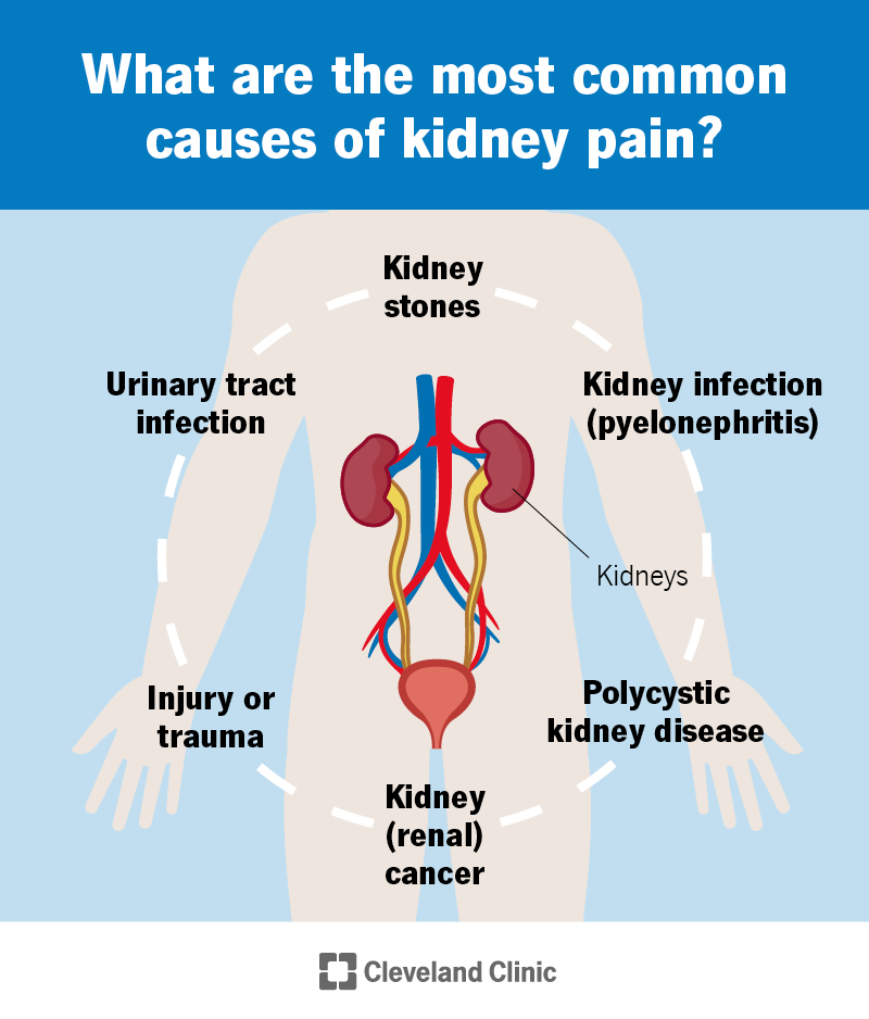 Kidney Pain: Causes, Treatment, and When to See a Healthcare Provider