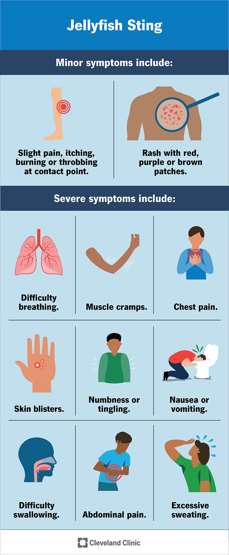 Minor symptoms of a jellyfish sting may include slight pain, itching and a rash. More serious stings can cause severe symptoms such as difficulty breathing.
