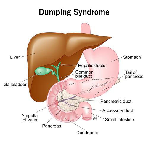 Diagram of the stomach connected to the upper part of the small intestine (duodenum).