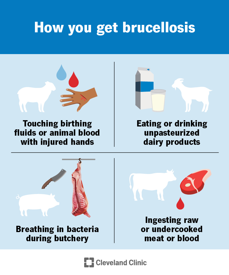 How you get brucellosis, including touching infected animals, breathing it in or eating contaminated dairy products or meats