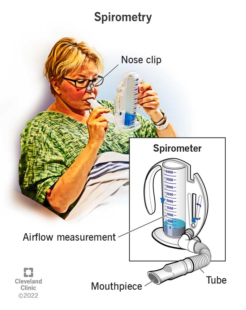 Spirometry is a type of pulmonary function testing that uses a spirometer to measure air flow and the amount of air in your lungs.