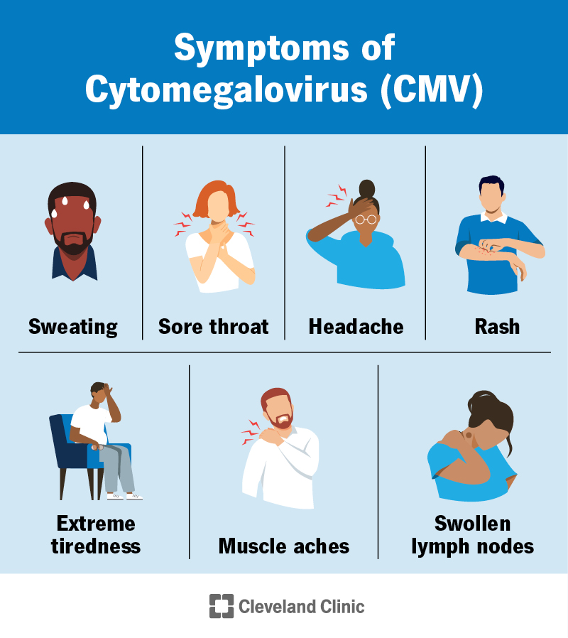 Symptoms of cytomegalovirus, including sore throat, headache, tiredness, muscle aches, sweating rash and swollen lymph nodes