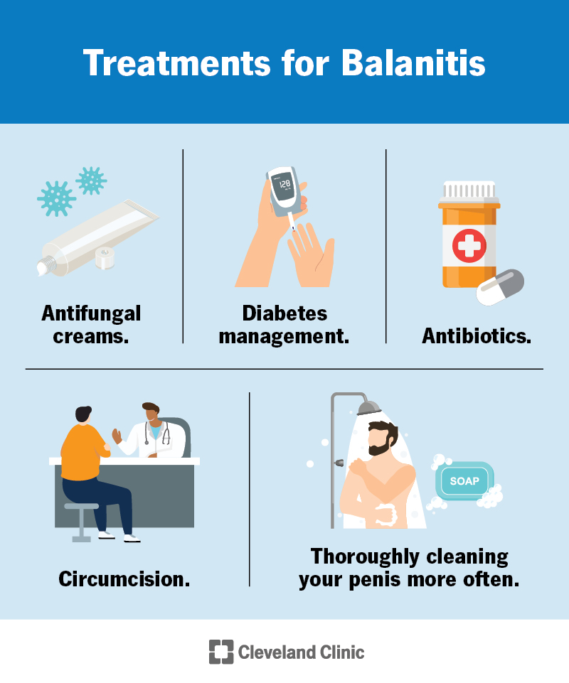Balanitis treatment depends on its cause. Regularly washing and drying you penis is often the best way to get rid of balanitis, but treatment may also include managing your diabetes, medications or circumcision.