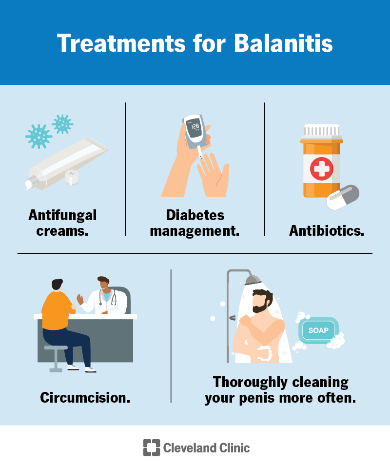 Balanitis: Causes, Symptoms, Treatment & Prevention