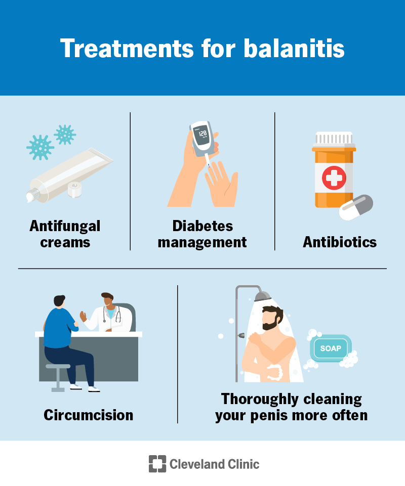 How To Treat Balanitis In Bathtub LRBO