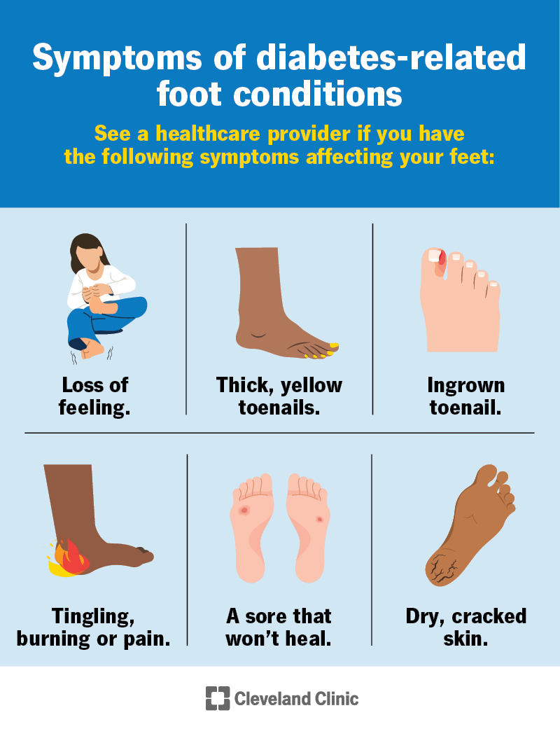 See a doctor if you have these symptoms: numbness, ingrown toenail, yellow nails, sores that won't heal, pain or cracked skin