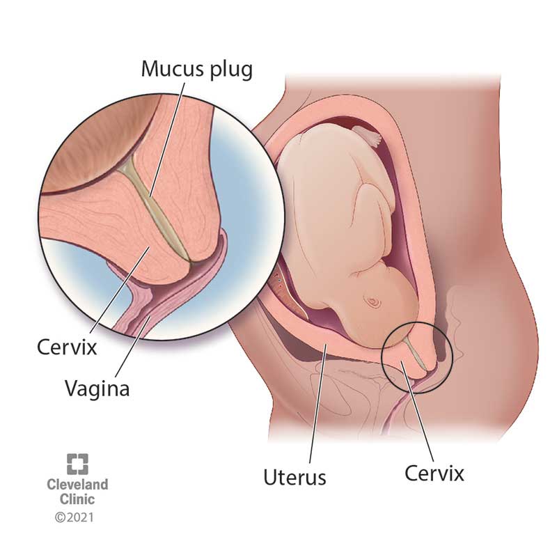 What mucus plug looks like in cervix while pregnant.