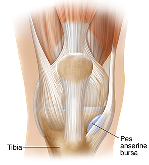 Pes Anserinus Bursitis