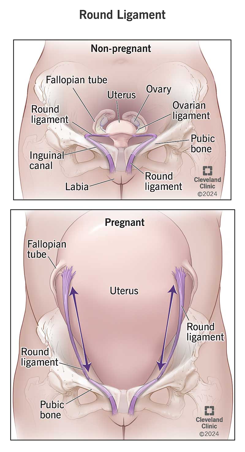 Comparison of what a round ligament looks like in pregnant and non-pregnant people.