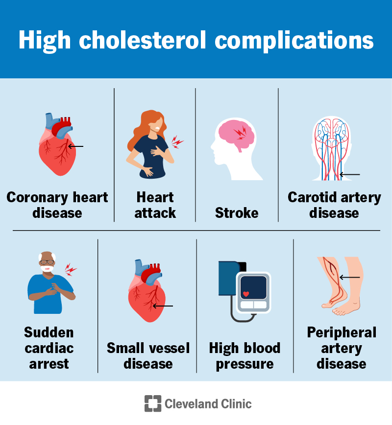High cholesterol can cause many complications (like a heart attack or stroke) that affect your heart and blood vessels
