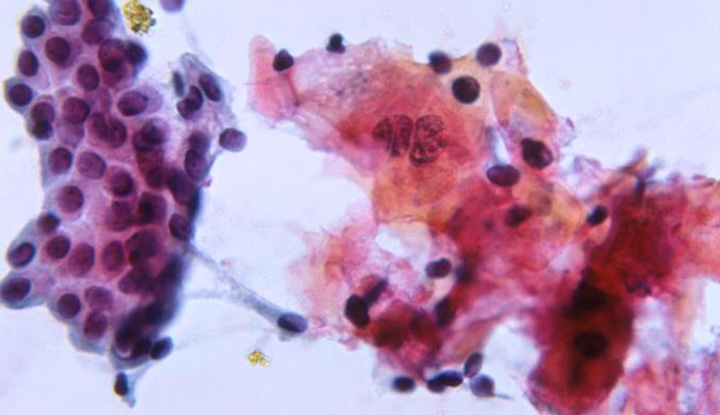 In cytology, cells are examined under a microscope.