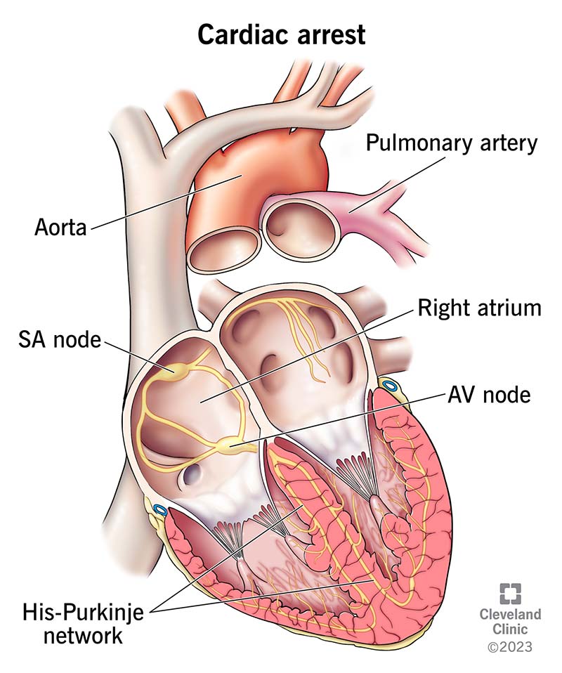 What Happens Inside Your Heart When Heart Failure Strikes