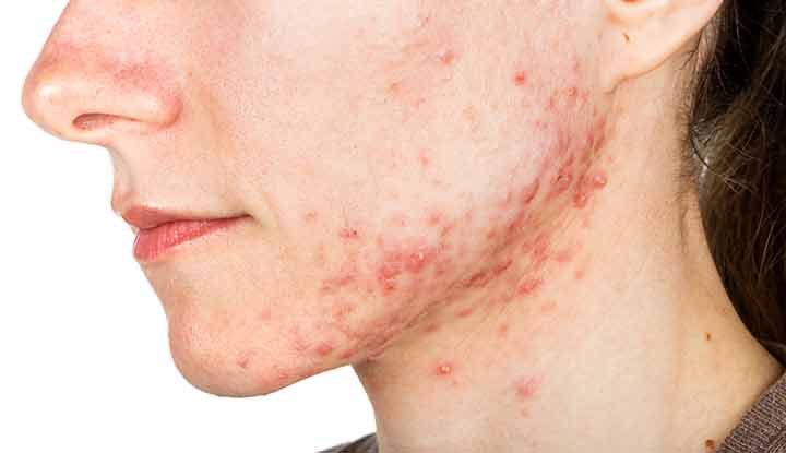 red bumps on face