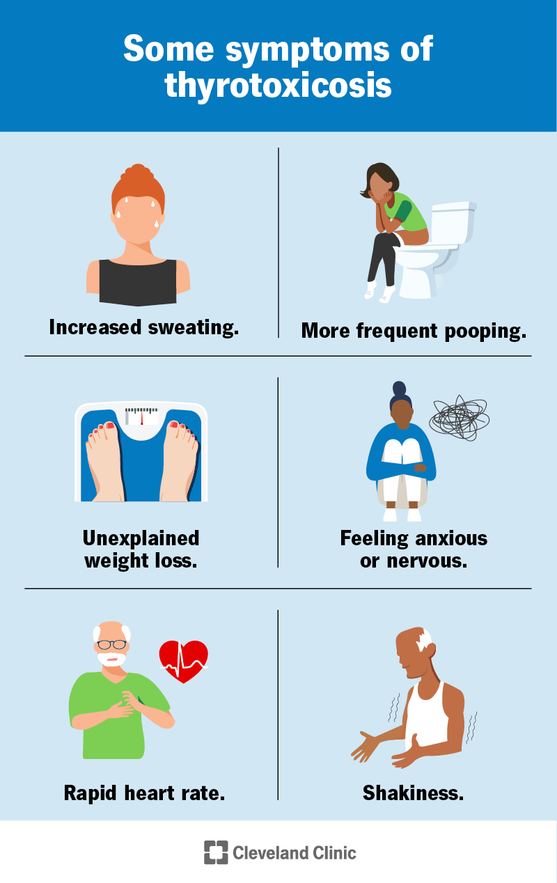 Symptoms of thyrotoxicosis include unexplained weight loss, rapid heart rate, shakiness, increased sweating and more.