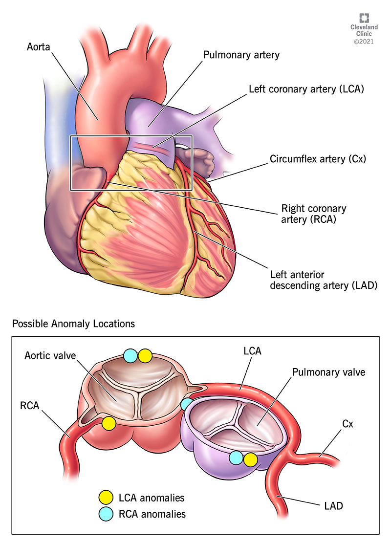 Dots showing possible locations of anomalous coronary arteries