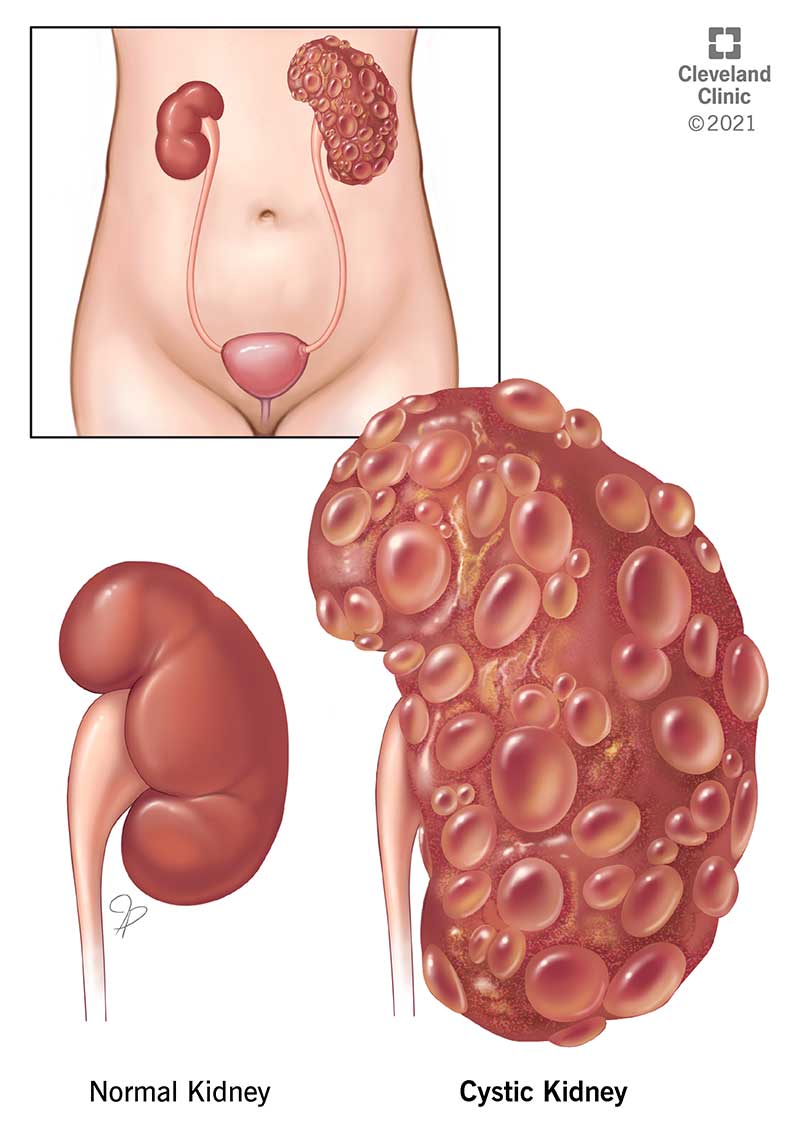 Kidney location, normal and cystic appearance.