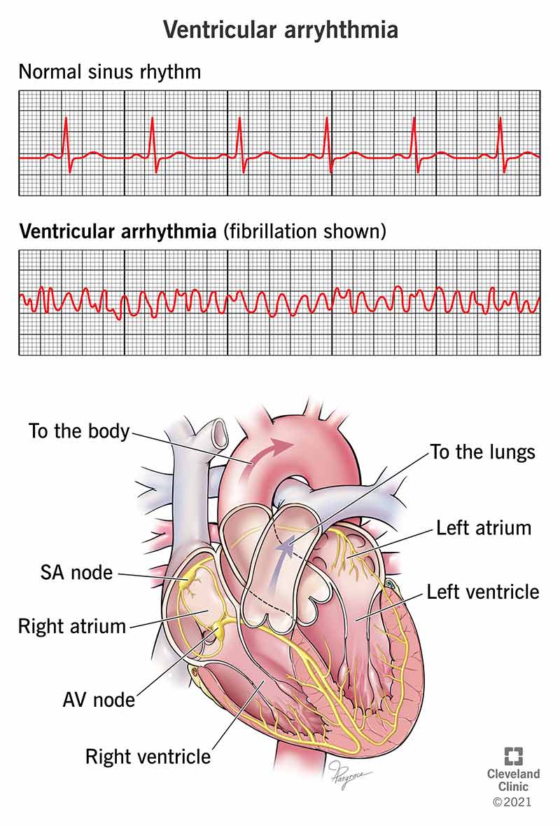 Heart rate versus heart rhythm