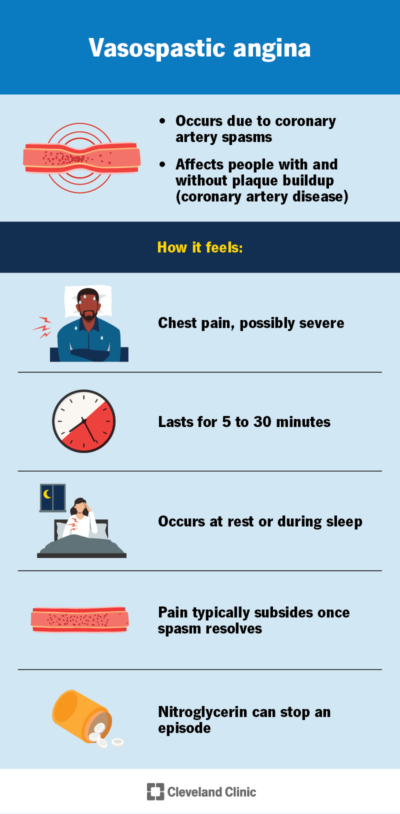 Why vasospastic angina occurs (coronary artery spasms), who it affects and how it can feel