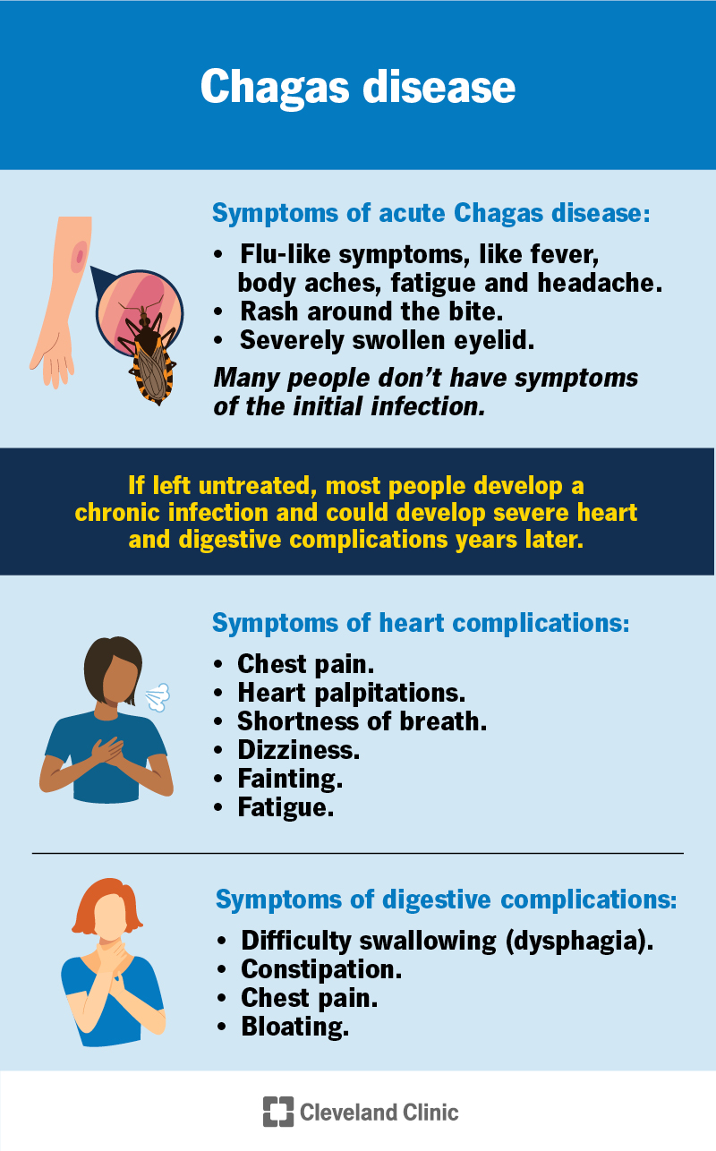 Chagas can cause flu-like symptoms or no symptoms; complications can cause chest pain, palpitations, issues eating and more