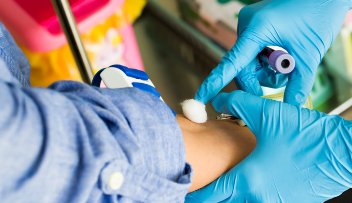 A chloride blood test requires a blood sample, usually taken from a vein in your arm.