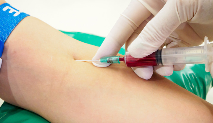 A needle puncturing a vein in the inner side of a person's elbow. The needle is connected to a syringe that's filled with blood.