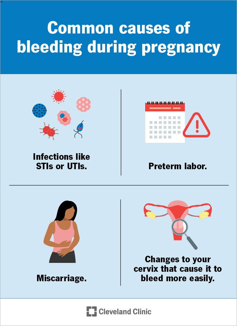 Some common reasons for vaginal bleeding during pregnancy are a sensitive cervix, infection, premature labor or miscarriage