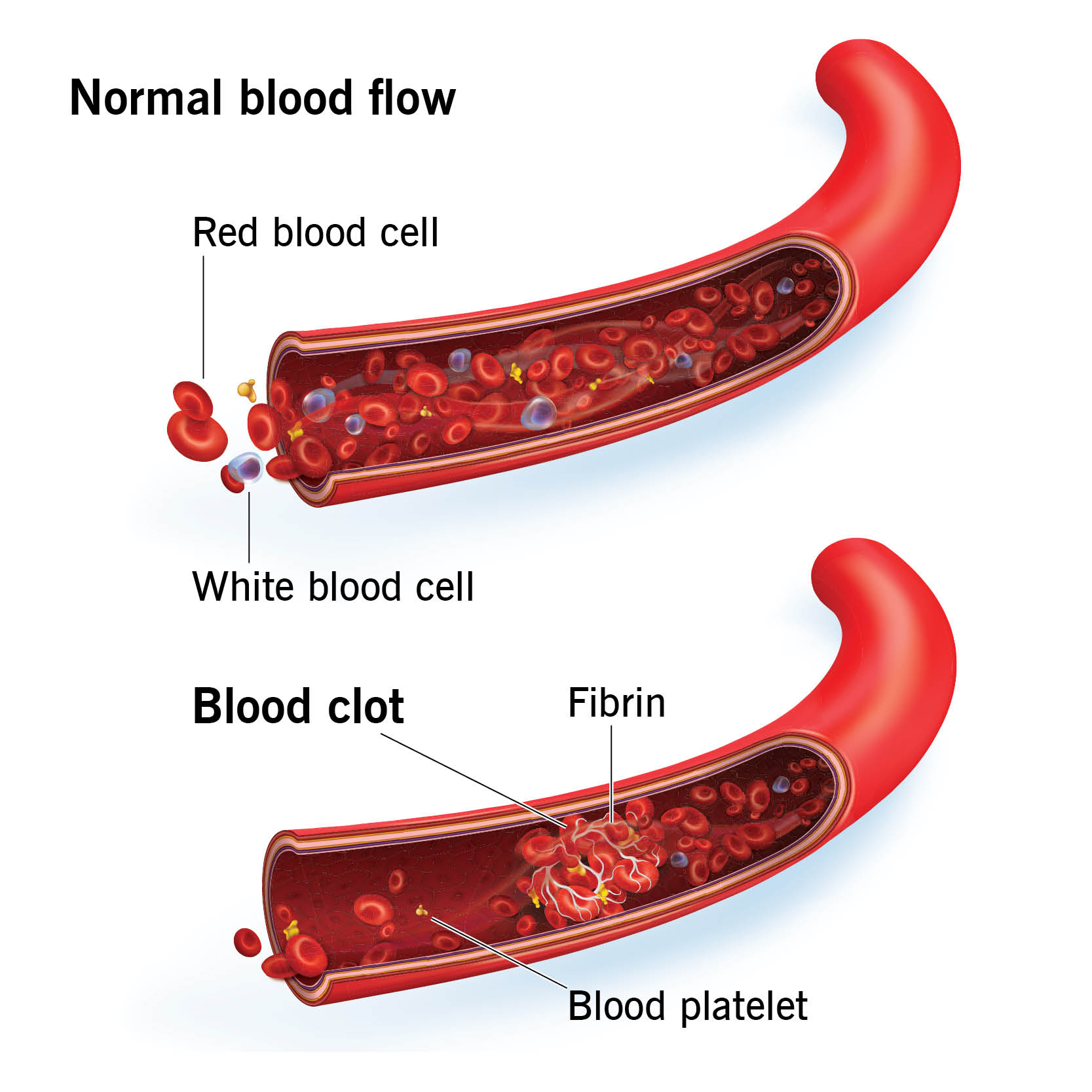 D-Dimer Test Blood Sample