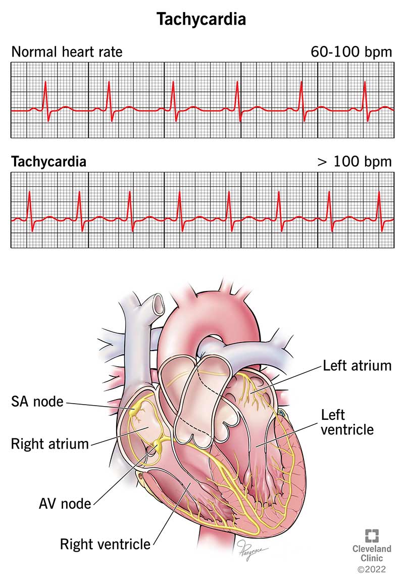 strong heart beats cause