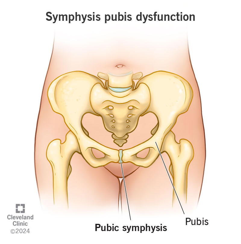 Pubic symphysis joint in the pelvis