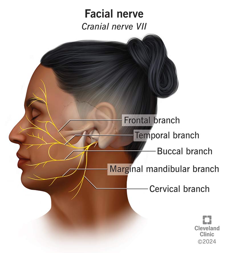 Side profile of a person's face, with the courses of the five branches of the facial nerve