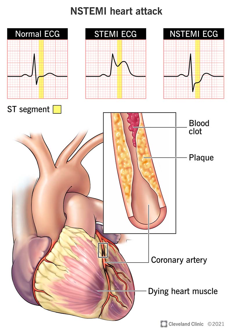 Get a cardiovascular assessment - Body Cardio