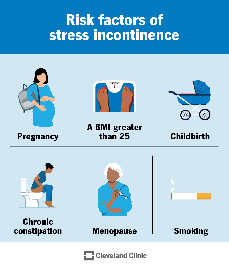 Common stress incontinence causes include pregnancy, childbirth, menopause, a BMI greater than 25 and chronic constipation
