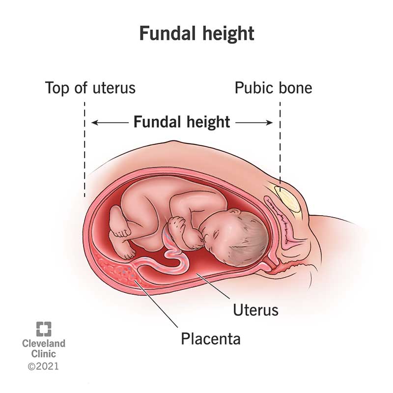 A person's abdomen with lines marking where fundal height is measured during pregnancy.