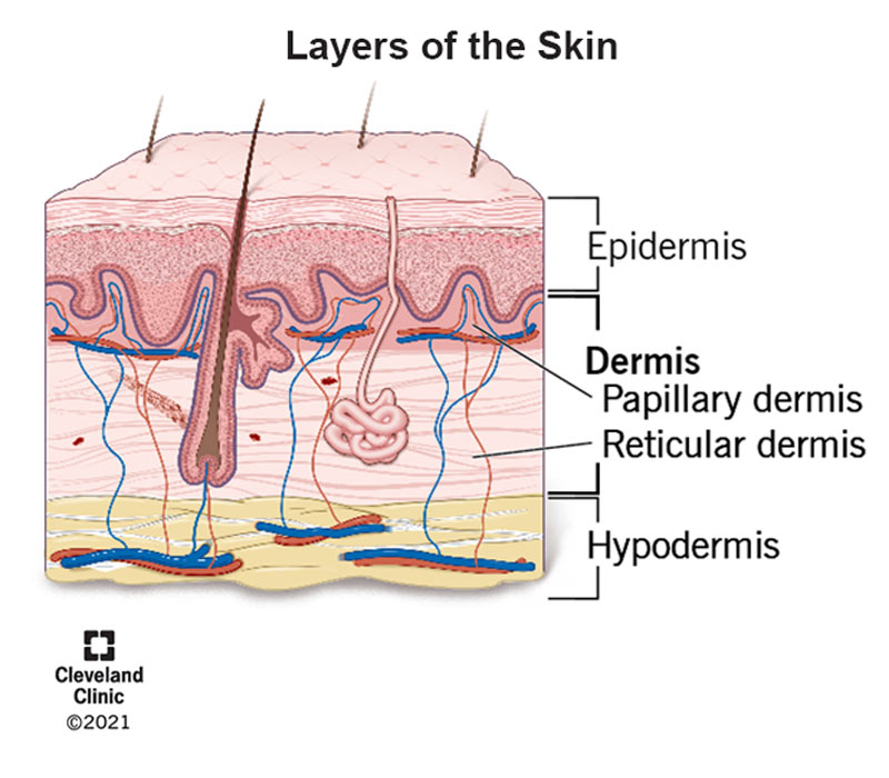 Cross section illustration of skin highlighting the dermis (middle layer) and its components, the papillary and reticular dermis.