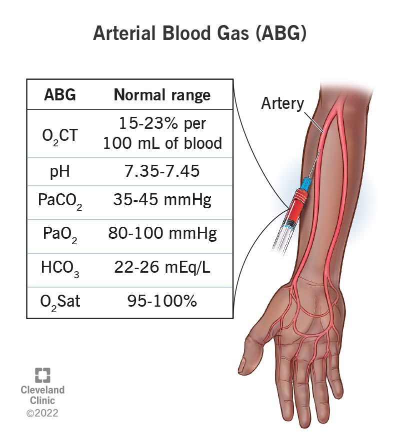 An arterial blood gas test takes a sample from your artery instead of your vein. It measures oxygen and carbon dioxide levels in your blood.