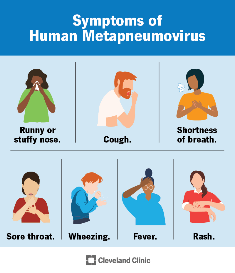 Symptoms of hMPV include fever, cough, runny or stuffy nose, wheezing, shortness of breath, sore throat and rash.
