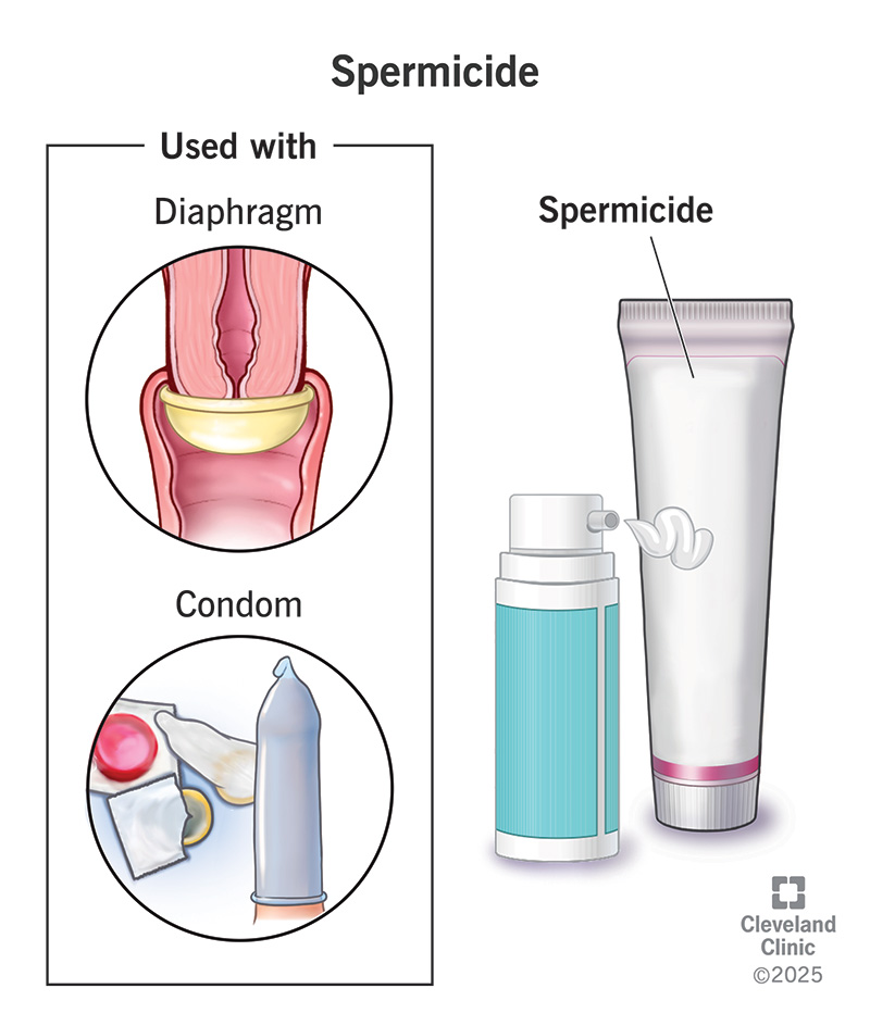 Spermicide in a tube being used with a condom and a vaginal diaphragm