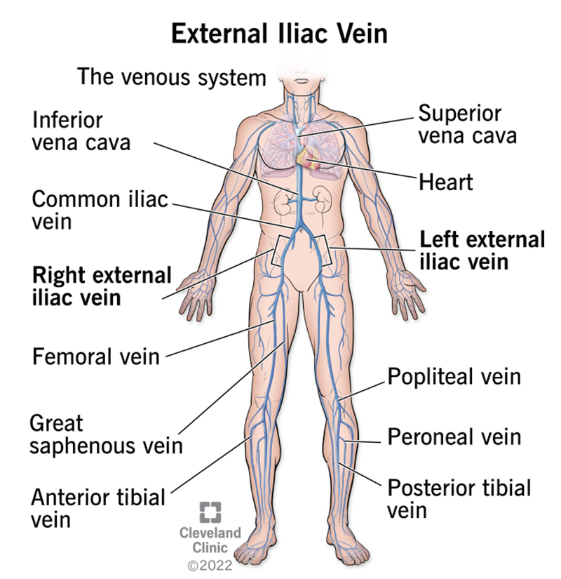 Diagram shows how your external iliac veins connect to the rest of your circulatory system.