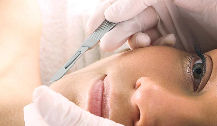 Healthcare provider in gloved hands holds tool for dermaplaning on a woman’s face.