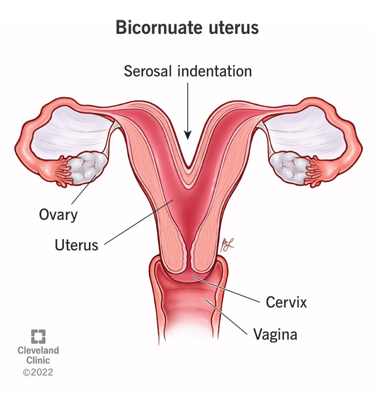 A heart-shaped uterus with the ovaries, vagina and cervix labeled.