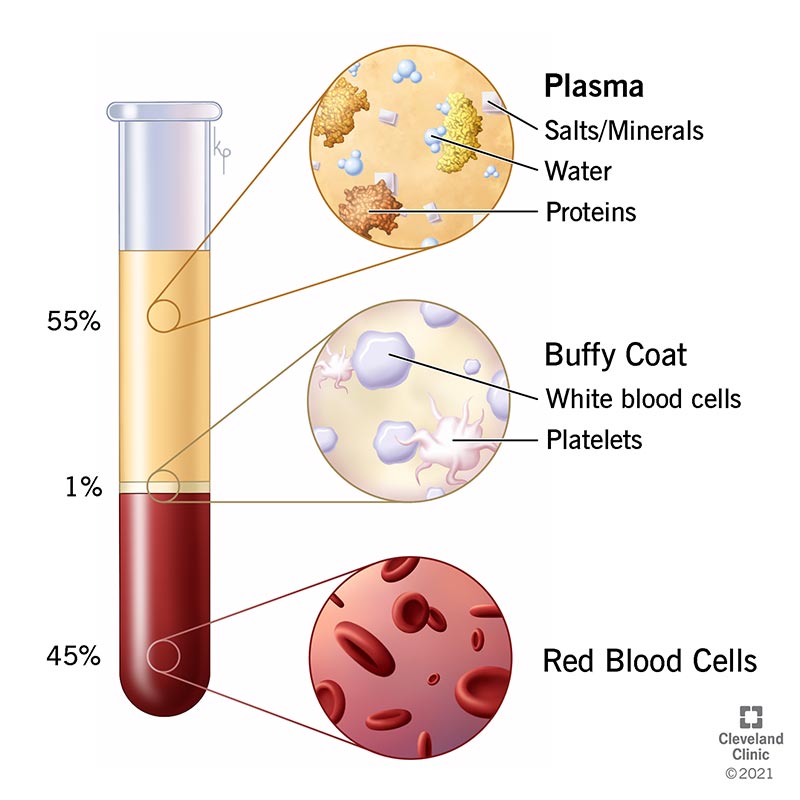 What is a plasma? 