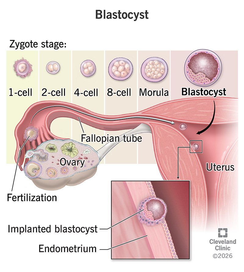 Blastocyst implanting in a uterus
