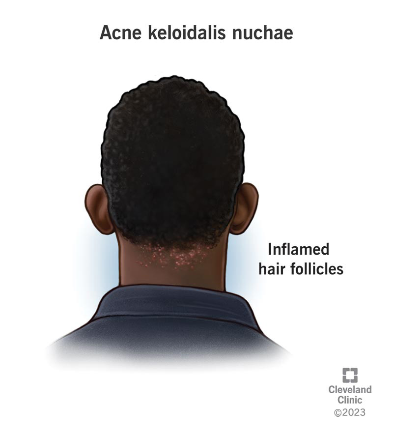 Red spots on scalp: Pictures, causes, and treatments